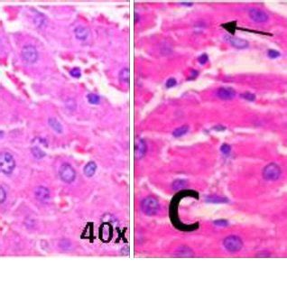 Liver Photomicrography Of Male Wistar Rats Treated Orally With Eeas For