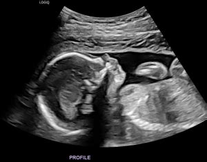 Southwest Ultrasound – St. Thomas, Ontario