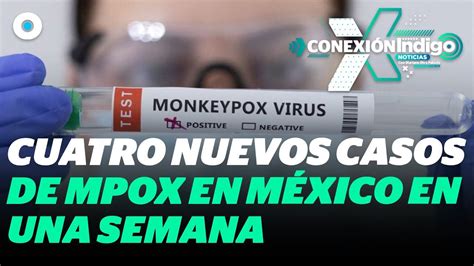 Aumentan a 53 los casos de Mpox en México CDMX encabeza lista de