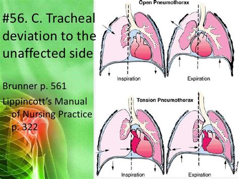 Respiratory Function And Disorders Part 2