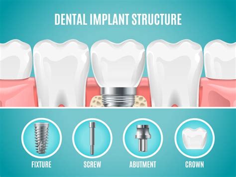 Teeth Maquette Structural Elements Of Dental Vector Image