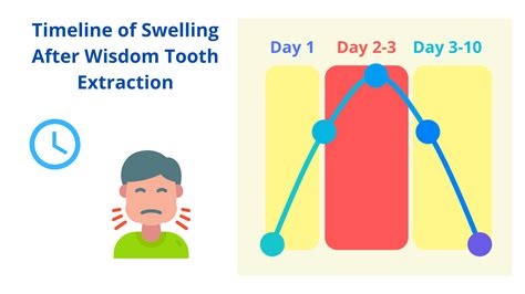 Lump In The Cheek After Wisdom Teeth Removal Should You Worry