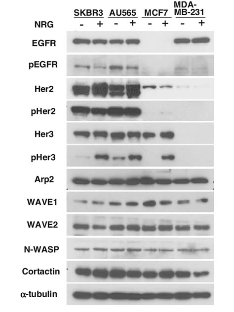 Immunoblot Analysis Of The Four Breast Cancer Cell Lines Protein