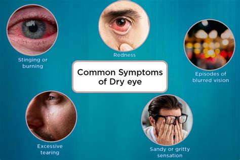 Relieving Dry Eye Syndrome The Benefits Of Treatment Advanced Eye Clinic