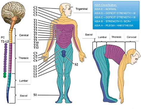 Figure 1 From Neurogenic Shock Clinical Management And Particularities