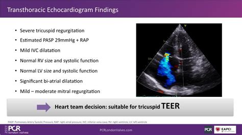 Advancing Valve Repair Mastering Diverse Mitral And Tricuspid