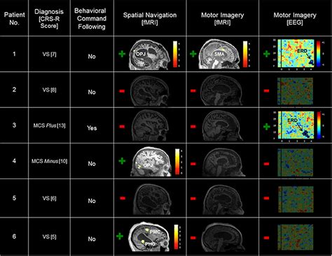 Summary Of Patient Results Across The Behavioral FMRI And EEG