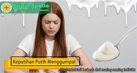 Keputihan Putih Menggumpal Pada Wanita Dan Cara Mengelolanya Klinik