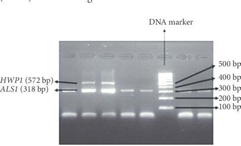 Figure Multiplex Pcr Amplification Products Showing Presence Of The