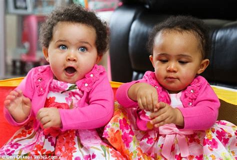 First Identical Twins With Different Skin Colour Born In The Uk Daily