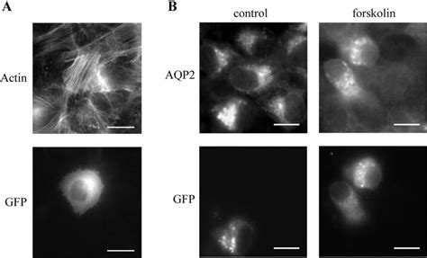 Effect Of The Expression Of A Constitutively Active Mutant Of Rhoa