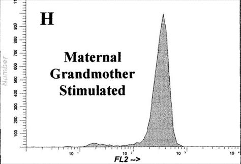 Chronic Granulomatous Disease In Two Children With Recurrent Infections