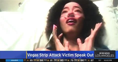 Victim In Vegas Strip Stabbing Retells Tragic Details Cbs Los Angeles