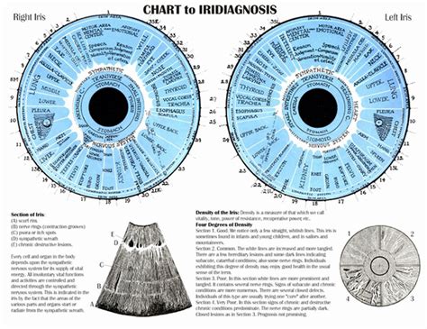 Iridology Diagnosis Chart Here S A Quick Way To Know Maikong