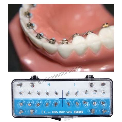 Dental Lingual Braces Metal Brace Palatal Bracket In Teeth Free Buccal