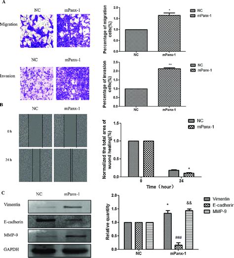 Effect Of Overexpression Of Panx On The Invasion And Metastasis