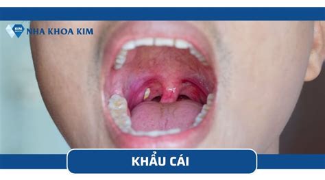 Khoang miệng là gì? Cấu tạo và chức năng của khoang miệng