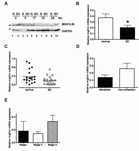 A Representative Western Blot Showing Migfilin Expression In Breast