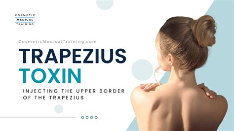 Trap Tox Botox Injection Technique Into The Trapezius Muscles