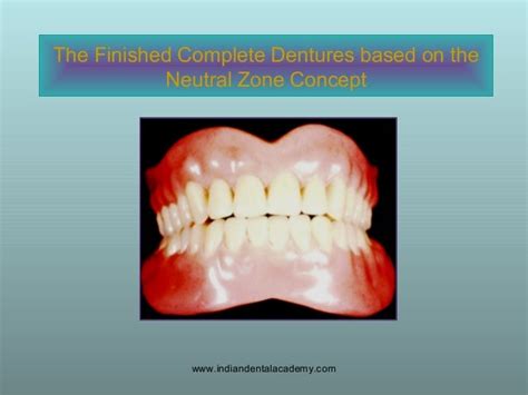 Concept Of Neutral Zone Dental Seminars