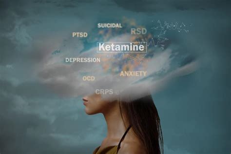 Myths And Facts About Ketamine Palo Alto Mind Body Concierge Psychiatry