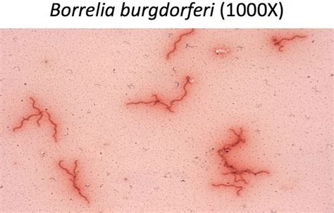 Borrelia Burgdorferi Gram Negative Spirochete Can Cause Lyme Disease