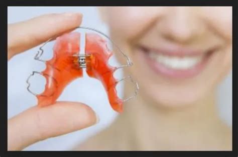 Palatal Expander Treatment Service in Bengaluru | ID: 21628805033