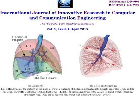 Figure From Automatic Lobar Segmentation Algorithm Forpulmonary Lobes