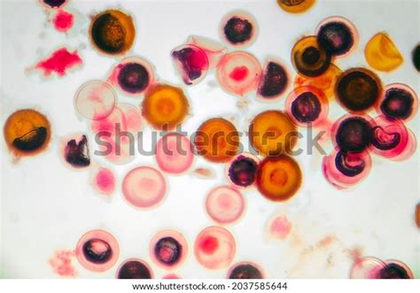 468 Taenia Solium Images Stock Photos Vectors Shutterstock