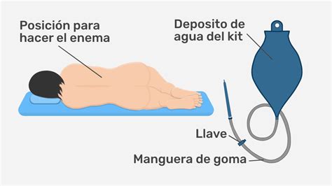 ¿cómo Hacer Un Enema O Lavado Intestinal En Casa Paso A Paso Tua Saúde