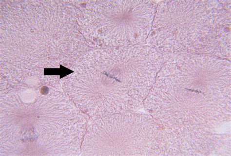 Metaphase Mitosis Under Microscope