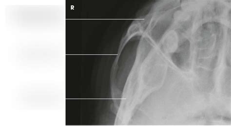 X-ray Anatomy - Tangential Zygomatic Arch Diagram | Quizlet