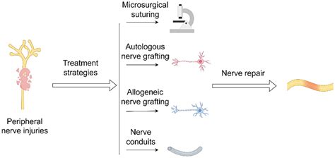 Frontiers Advancements In Autologous Peripheral Nerve Transplantation Care A Review Of