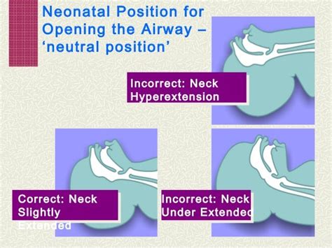 Neonatal Resuscitation