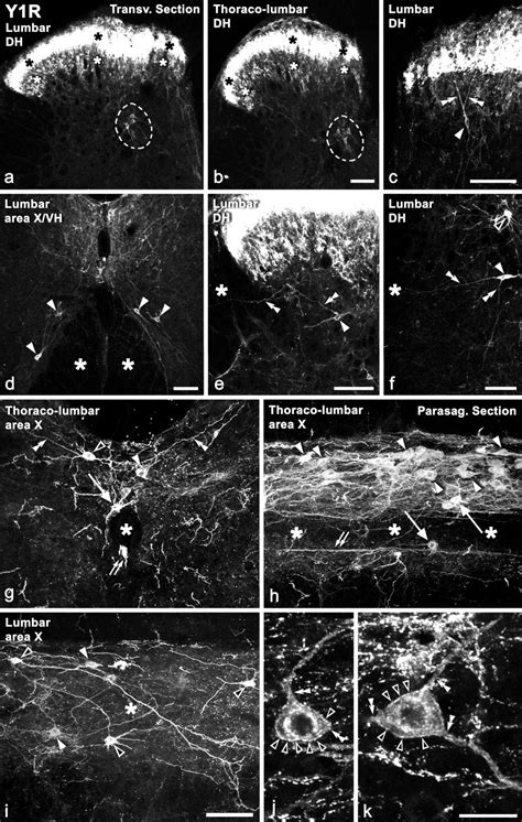 The Neuropeptide Tyrosine Y1R Is Expressed In Interneurons And