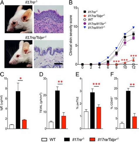 Il 17 Receptor A Maintains And Protects The Skin Barrier To Prevent