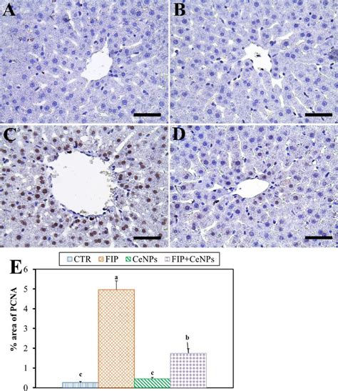 Immunohistochemical Staining Of Rat Liver By Proliferating Cell Nuclear