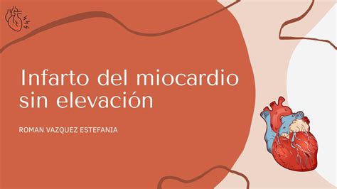 Infarto Al Miocardio Sin Elevación Estefania Roman Udocz