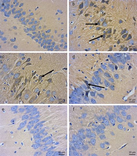 Photomicrographs Of Histological Sections Of The CA3 Region Of