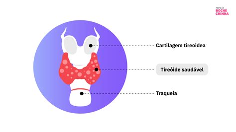 Hipotireoidismo Cong Nito Diagn Stico E Tratamento Teste Da Bochechinha