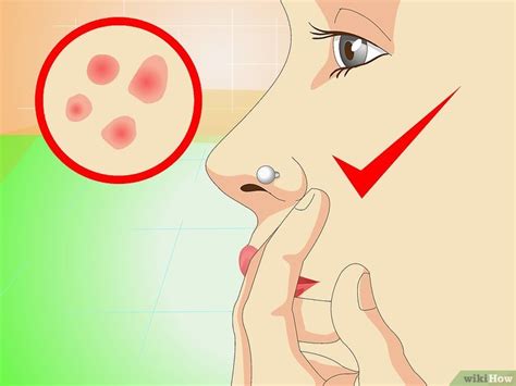 How To Treat An Infected Nose