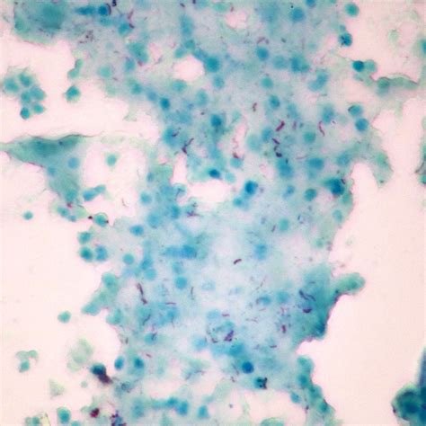 Mycobacterium tuberculosis, w.m. Microscope Slide - Walmart.com ...