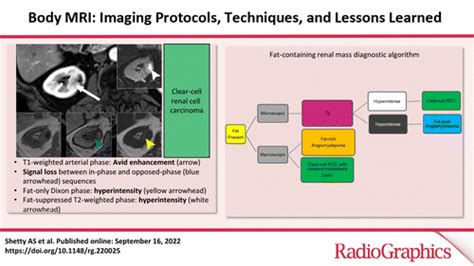 Body Mri Imaging Protocols Techniques And Lessons Learned