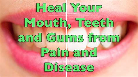 19+ Pain On Teeth And Gums Gif - Teeth Walls Collection For Everyone