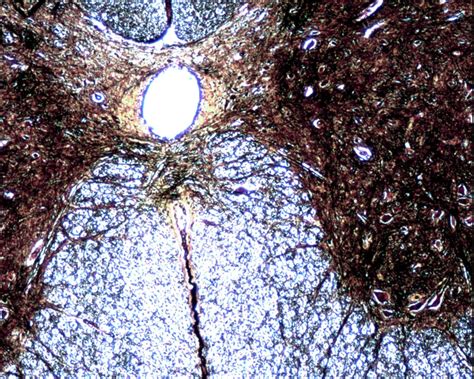 Lab 16 Spinal Cord Cross Section Histology Diagram Quizlet