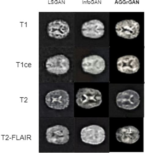 Visual comparison between sample generated images by existing GAN ...