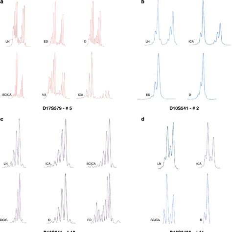 Different Genetic Alterations In Cancerous And Non Cancerous Breast