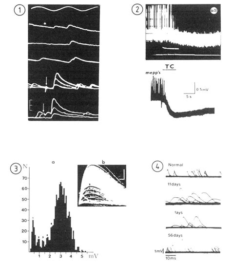 The Four Phenomenological Types Of Transmitter Release As Revealed By