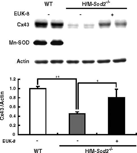 Gap Junction Protein Connexin 43 Cx43 Is Degraded In H M Sod2