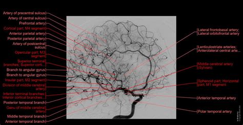 Arteries Of Brain Angiography Normal Anatomy E Anatomy